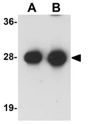 Anti-Synaptogyrin 3 antibody used in Western Blot (WB). GTX31397