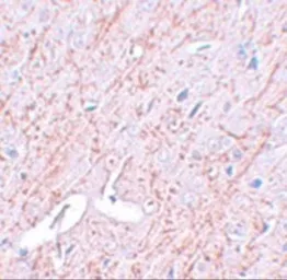 Anti-GATA3 antibody used in IHC (Paraffin sections) (IHC-P). GTX31401