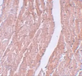 Anti-MINA53 antibody used in IHC (Paraffin sections) (IHC-P). GTX31403