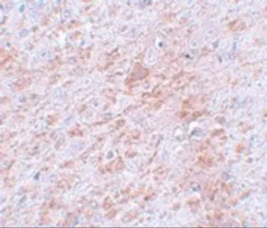 Anti-DCAMKL2 antibody used in IHC (Paraffin sections) (IHC-P). GTX31404