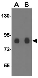 Anti-DCAMKL2 antibody used in Western Blot (WB). GTX31404