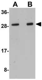 Anti-LYRM1 antibody used in Western Blot (WB). GTX31407