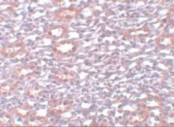 Anti-PIAS1 antibody used in IHC (Paraffin sections) (IHC-P). GTX31410