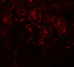 Anti-PIAS1 antibody used in IHC (Paraffin sections) (IHC-P). GTX31410