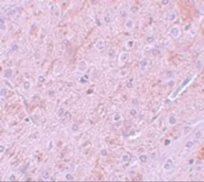 Anti-PIAS2 antibody used in IHC (Paraffin sections) (IHC-P). GTX31411
