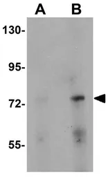 Anti-PIAS2 antibody used in Western Blot (WB). GTX31411