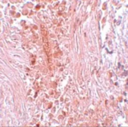 Anti-PIAS3 antibody used in IHC (Paraffin sections) (IHC-P). GTX31412