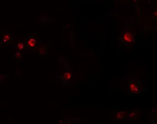 Anti-USP10 antibody used in Immunocytochemistry/ Immunofluorescence (ICC/IF). GTX31416