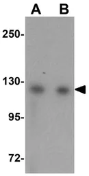 Anti-USP10 antibody used in Western Blot (WB). GTX31416