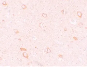 Anti-CIITA antibody used in IHC (Paraffin sections) (IHC-P). GTX31419