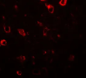 Anti-CIITA antibody used in IHC (Paraffin sections) (IHC-P). GTX31419