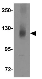 Anti-CIITA antibody used in Western Blot (WB). GTX31419