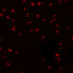 Anti-KPNA3 antibody used in Immunocytochemistry/ Immunofluorescence (ICC/IF). GTX31420