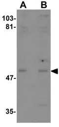 Anti-KPNA3 antibody used in Western Blot (WB). GTX31420