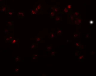 Anti-TRIP6 antibody used in Immunocytochemistry/ Immunofluorescence (ICC/IF). GTX31421