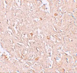 Anti-FBXL16 antibody used in IHC (Paraffin sections) (IHC-P). GTX31424