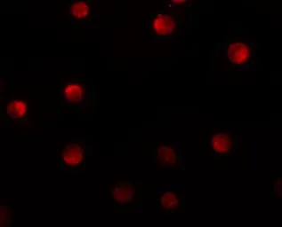 Anti-N4BP1 antibody used in Immunocytochemistry/ Immunofluorescence (ICC/IF). GTX31425
