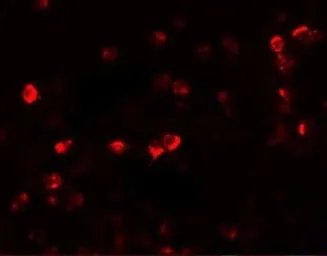 Anti-OGFOD1 antibody used in Immunocytochemistry/ Immunofluorescence (ICC/IF). GTX31426