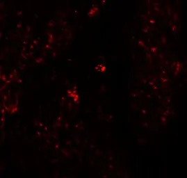 Anti-CD168 / RHAMM antibody used in IHC (Paraffin sections) (IHC-P). GTX31428