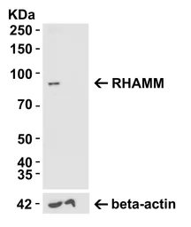 Anti-CD168 / RHAMM antibody used in Western Blot (WB). GTX31428