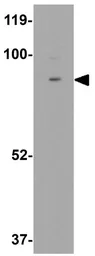 Anti-CD168 / RHAMM antibody used in Western Blot (WB). GTX31428