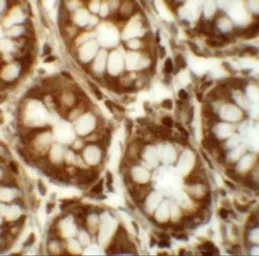 Anti-LRRFIP2 antibody used in IHC (Paraffin sections) (IHC-P). GTX31429