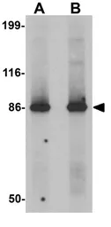 Anti-LRRFIP2 antibody used in Western Blot (WB). GTX31429