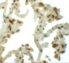 Anti-TM4SF1 antibody used in IHC (Paraffin sections) (IHC-P). GTX31430