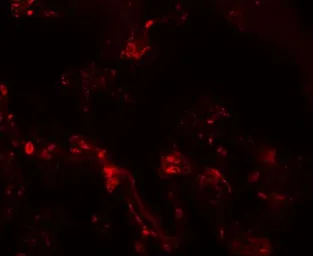 Anti-TM4SF1 antibody used in IHC (Paraffin sections) (IHC-P). GTX31430
