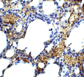 Anti-TM4SF1 antibody used in IHC (Paraffin sections) (IHC-P). GTX31430