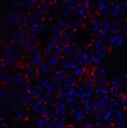 Anti-TM4SF1 antibody used in IHC (Paraffin sections) (IHC-P). GTX31430