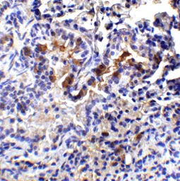 Anti-TM4SF1 antibody used in IHC (Paraffin sections) (IHC-P). GTX31430