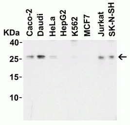 Anti-LIF antibody used in Western Blot (WB). GTX31431