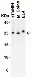 Anti-LIF antibody used in Western Blot (WB). GTX31431