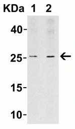 Anti-LIF antibody used in Western Blot (WB). GTX31431