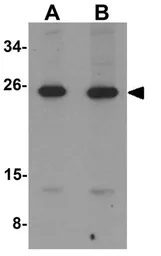 Anti-LIF antibody used in Western Blot (WB). GTX31431