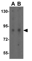 Anti-DYRK1A antibody used in Western Blot (WB). GTX31433