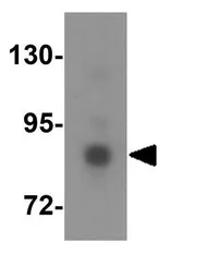 Anti-DYRK1A antibody used in Western Blot (WB). GTX31433