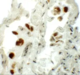 Anti-NUMB antibody used in IHC (Paraffin sections) (IHC-P). GTX31439