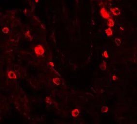 Anti-NUMB antibody used in IHC (Paraffin sections) (IHC-P). GTX31439