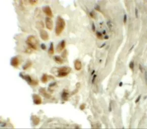 Anti-TYW1 antibody used in IHC (Paraffin sections) (IHC-P). GTX31441