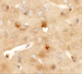 Anti-CCDC141 antibody used in IHC (Paraffin sections) (IHC-P). GTX31445