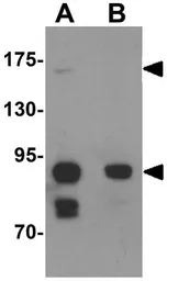 Anti-CCDC141 antibody used in Western Blot (WB). GTX31445