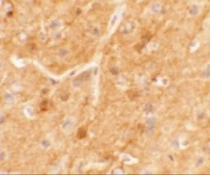 Anti-SPRYD5 antibody used in IHC (Paraffin sections) (IHC-P). GTX31446