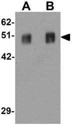 Anti-SPRYD5 antibody used in Western Blot (WB). GTX31446