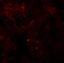 Anti-Coronin 7 antibody used in IHC (Paraffin sections) (IHC-P). GTX31451