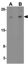 Anti-Transmembrane protein 147 antibody used in Western Blot (WB). GTX31452