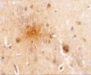 Anti-SEC62 antibody used in IHC (Paraffin sections) (IHC-P). GTX31455