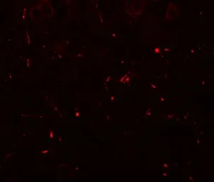 Anti-SEC62 antibody used in IHC (Paraffin sections) (IHC-P). GTX31455