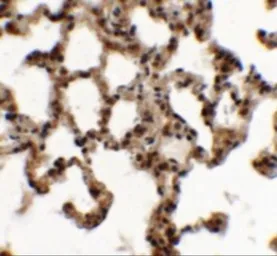 Anti-ECG2 antibody used in IHC (Paraffin sections) (IHC-P). GTX31458